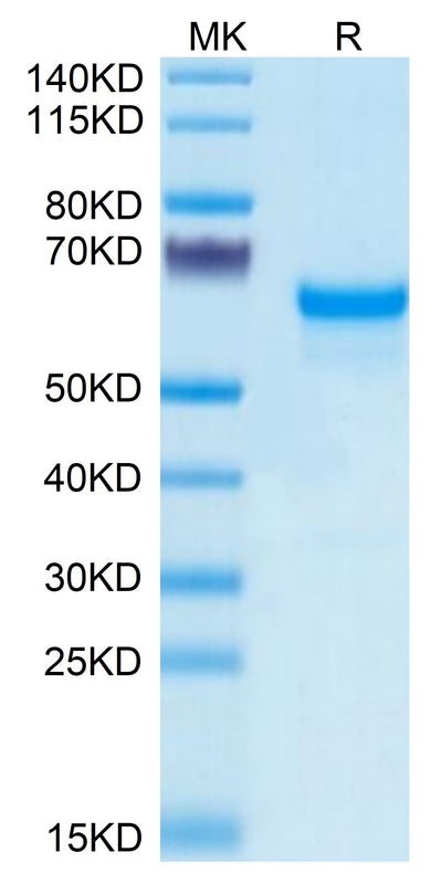 Human PRNP on Tris-Bis PAGE under reduced condition. The purity is greater than 95%.Recombinant Human PRNP Protein, Active