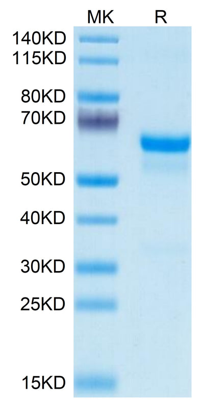 Mouse PRNP on Tris-Bis PAGE under reduced condition. The purity is greater than 95%.Recombinant Mouse PRNP Protein