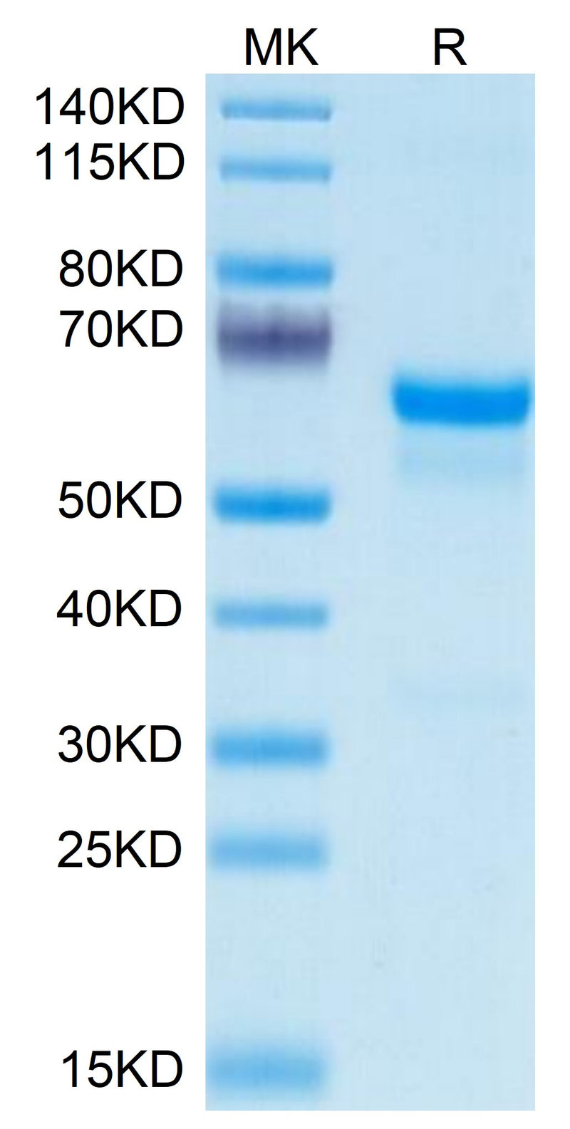 Mouse PRNP on Tris-Bis PAGE under reduced condition. The purity is greater than 95%.Recombinant Mouse PRNP Protein