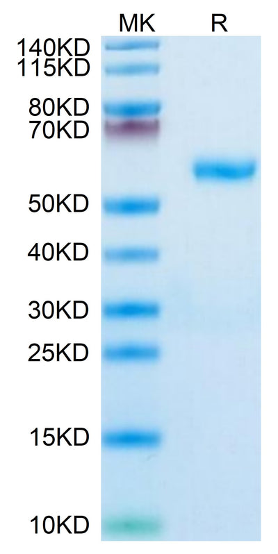 Human RNF43 on Tris-Bis PAGE under reduced condition. The purity is greater than 95%.Recombinant Human RNF43 Protein, Active