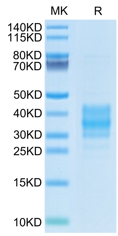 Cynomolgus FOLR2 on Tris-Bis PAGE under reduced condition. The purity is greater than 95%.Recombinant Cynomolgus FOLR2 Protein, Active