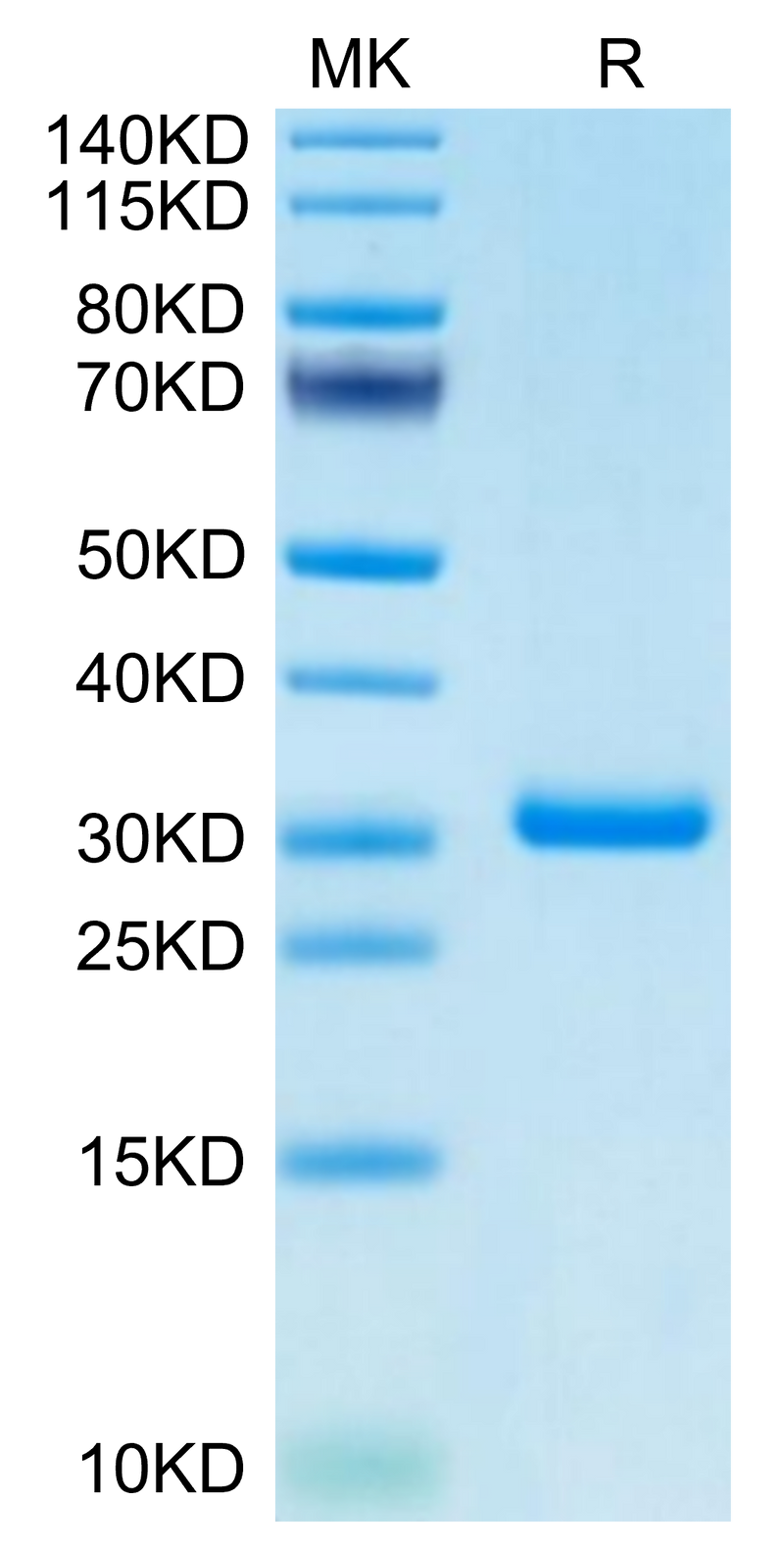 Cynomolgus BTN3A1 on Tris-Bis PAGE under reduced condition. The purity is greater than 95%.Recombinant Cynomolgus BTN3A1/CD277 Protein, Active