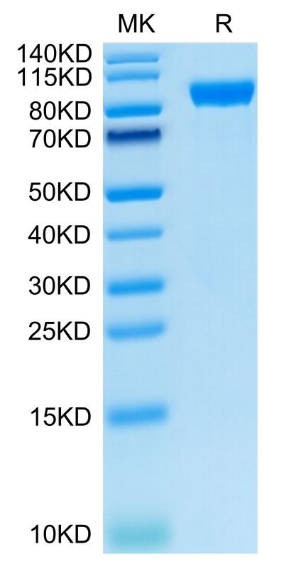 Human AXL on Tris-Bis PAGE under reduced condition. The purity is greater than 95%.Recombinant Human AXL Protein, Active