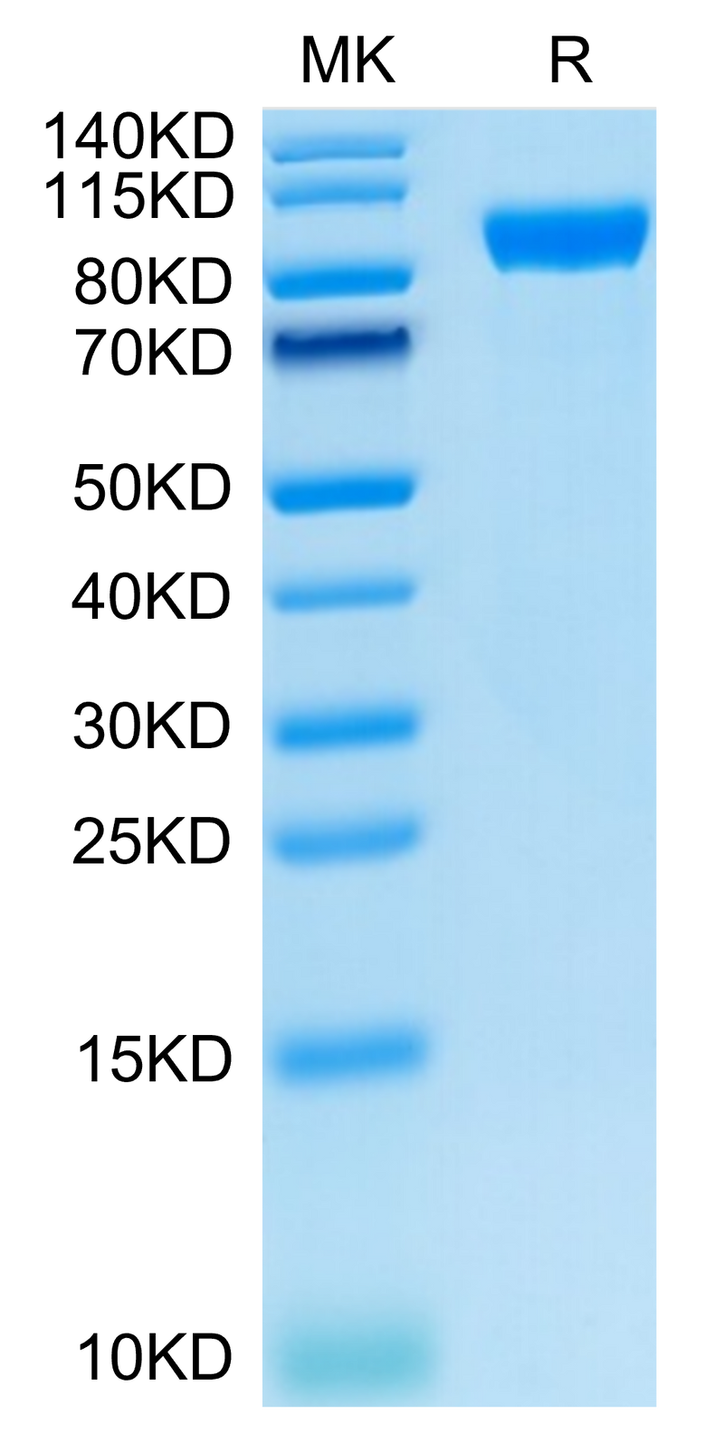 Human AXL on Tris-Bis PAGE under reduced condition. The purity is greater than 95%.Recombinant Human AXL Protein, Active