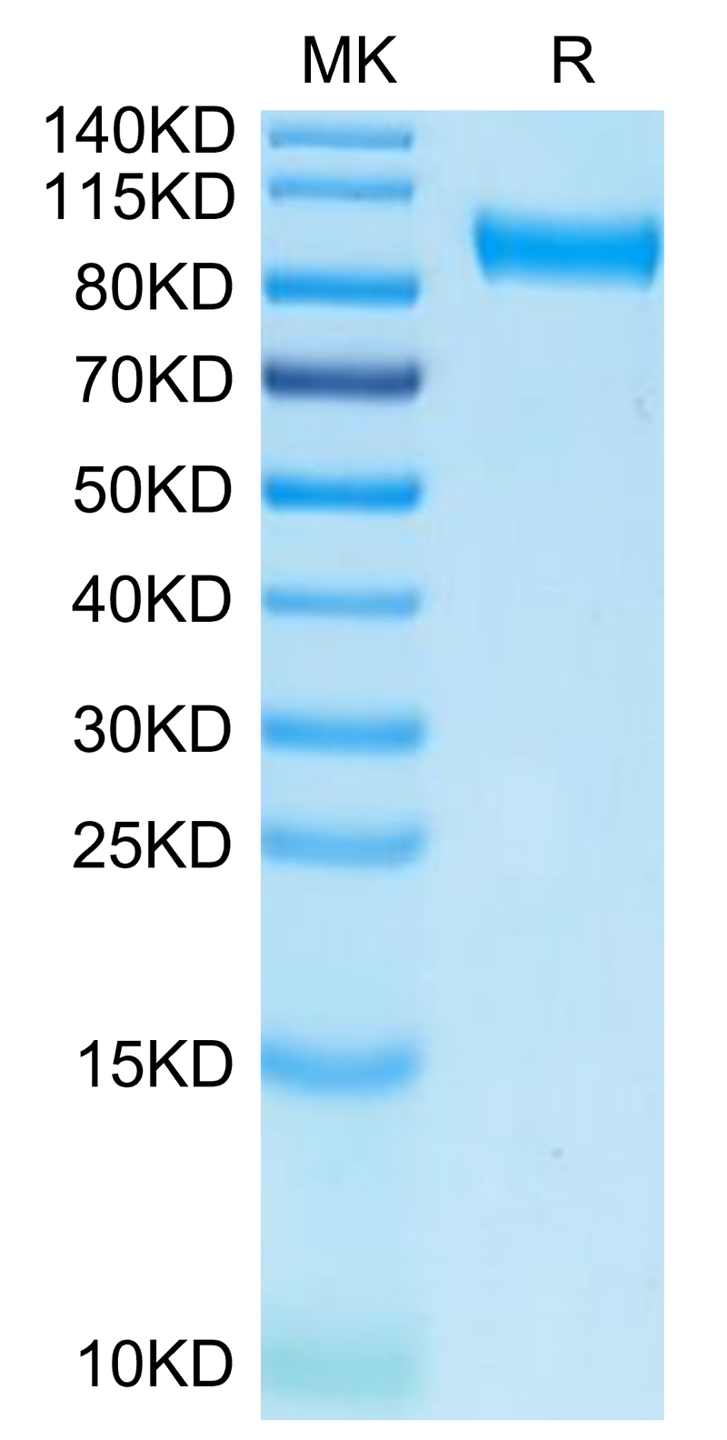 Biotinylated Human Axl on Tris-Bis PAGE under reduced condition. The purity is greater than 95%.Biotinylated Human Axl Protein (Primary Amine Labeling), Active