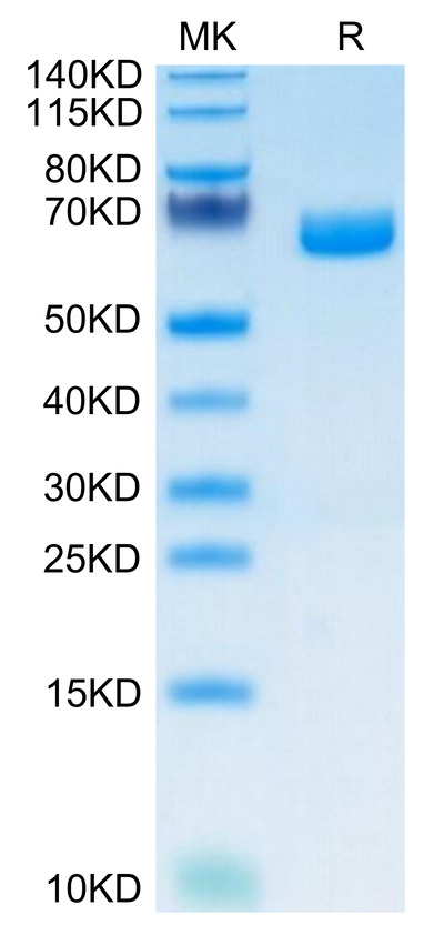 Mouse IL-22R alpha 1 on Tris-Bis PAGE under reduced condition. The purity is greater than 95%.Recombinant Mouse IL-22R alpha 1 Protein, Active