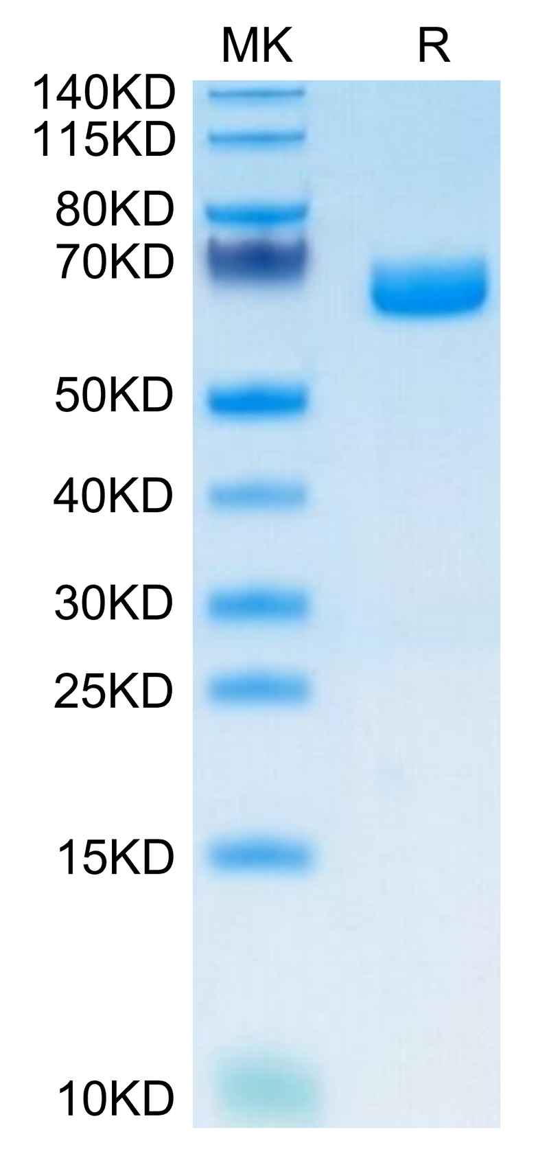 Mouse IL-22R alpha 1 on Tris-Bis PAGE under reduced condition. The purity is greater than 95%.Recombinant Mouse IL-22R alpha 1 Protein, Active