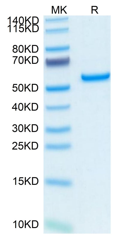 Human Pentraxin 2/SAP on Tris-Bis PAGE under reduced condition. The purity is greater than 95%.Recombinant Human Pentraxin 2/SAP Protein, Active