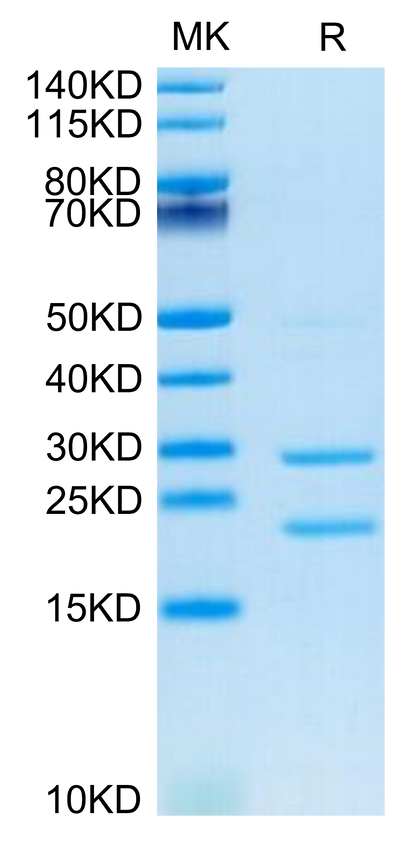 Cynomolgus MASP2 on Tris-Bis PAGE under reduced condition. The purity is greater than 95%.Recombinant Cynomolgus MASP2 Protein, Active