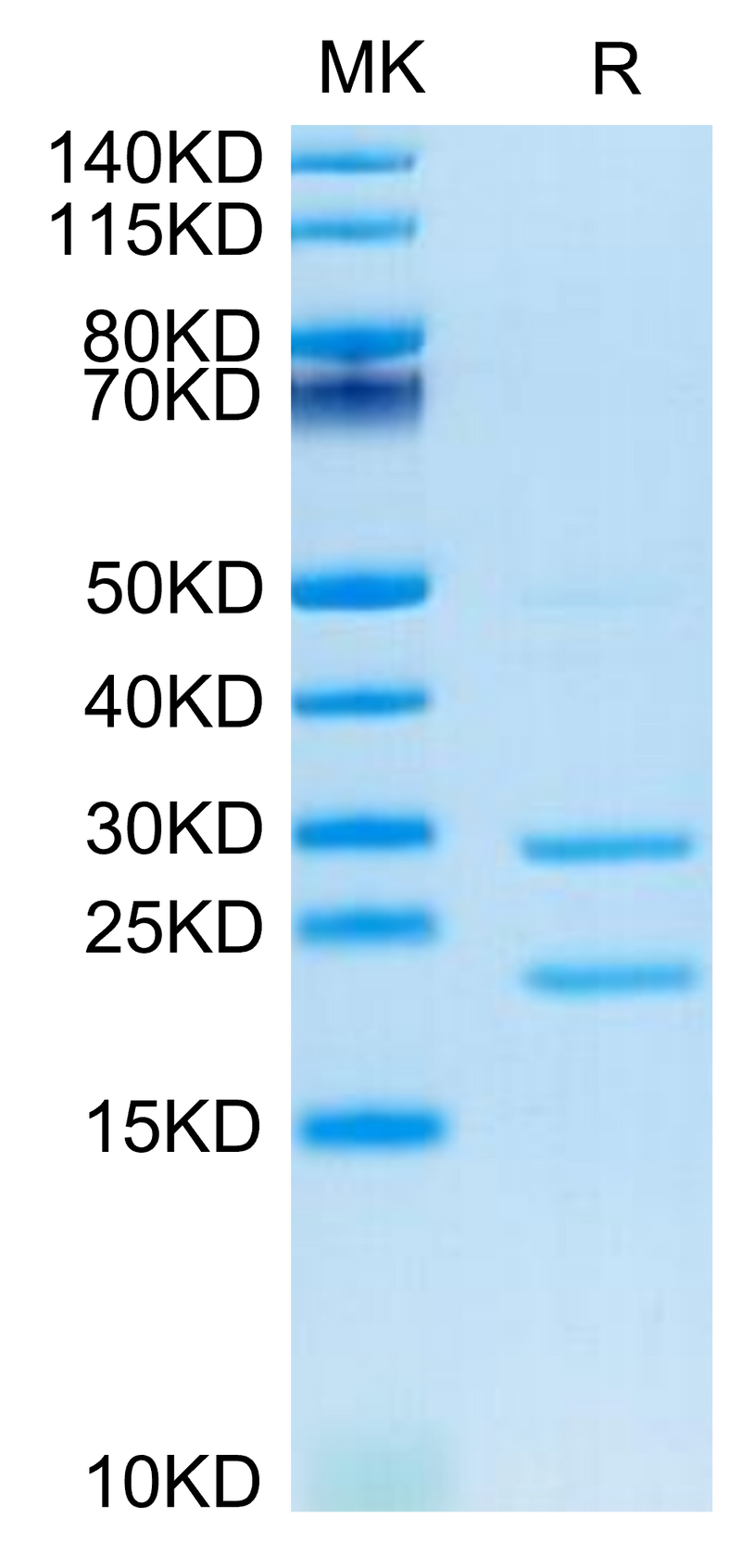 Cynomolgus MASP2 on Tris-Bis PAGE under reduced condition. The purity is greater than 95%.Recombinant Cynomolgus MASP2 Protein, Active