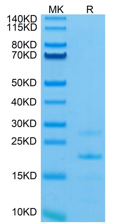 Mouse MASP2 on Tris-Bis PAGE under reduced condition. The purity is greater than 95%.Recombinant Mouse MASP2 Protein, Active