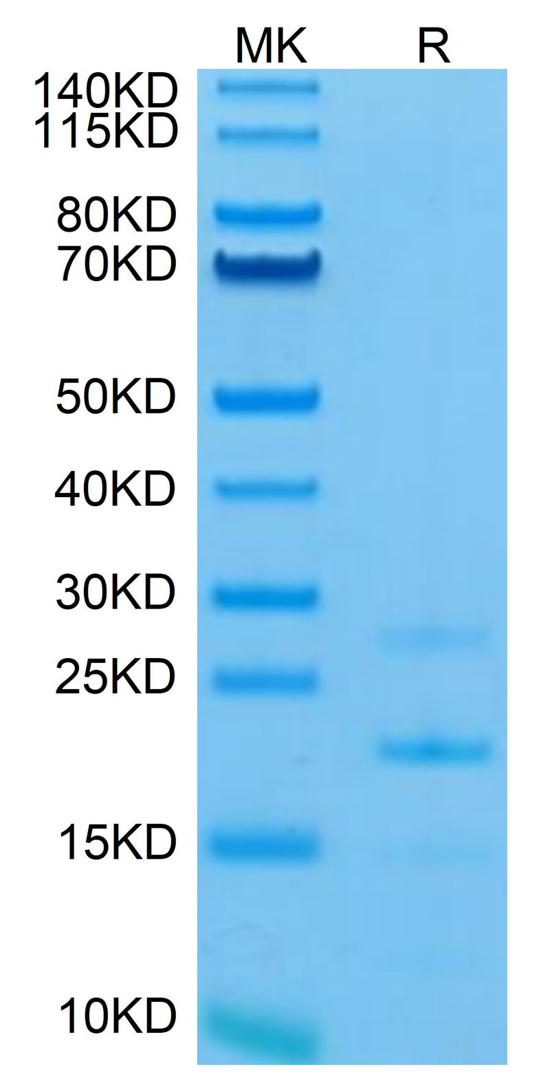 Mouse MASP2 on Tris-Bis PAGE under reduced condition. The purity is greater than 95%.Recombinant Mouse MASP2 Protein, Active