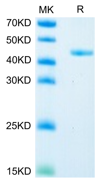 Mouse Glypican 2/GPC2 on Tris-Bis PAGE under reduced condition. The purity is greater than 95%.Recombinant Mouse Glypican 2/GPC2 Protein