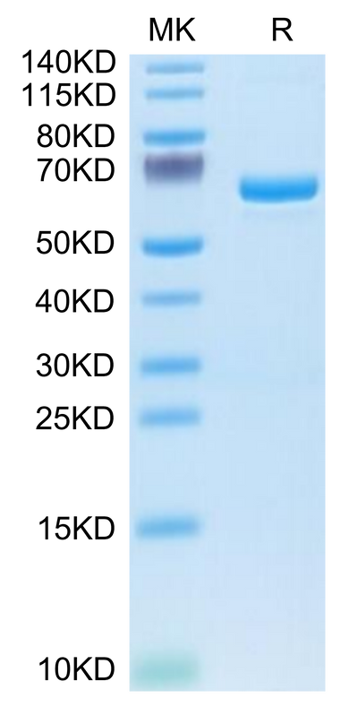 Human APOE4 on Tris-Bis PAGE under reduced condition. The purity is greater than 95%.Recombinant Human APOE4/Apolipoprotein E Protein