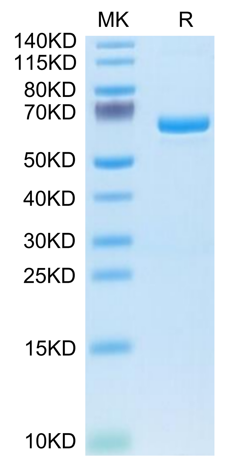 Human APOE4 on Tris-Bis PAGE under reduced condition. The purity is greater than 95%.Recombinant Human APOE4/Apolipoprotein E Protein