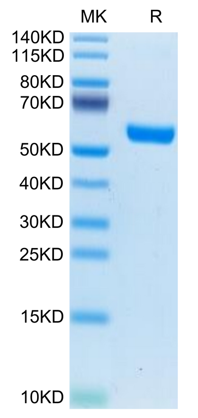 Human IL-19 on Tris-Bis PAGE under reduced condition. The purity is greater than 95%.Recombinant Human IL-19 Protein