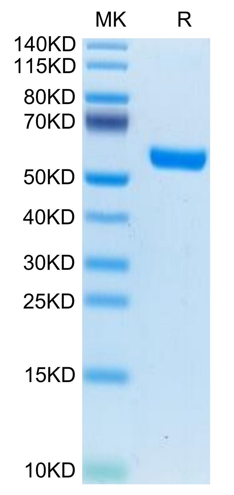 Human IL-19 on Tris-Bis PAGE under reduced condition. The purity is greater than 95%.Recombinant Human IL-19 Protein