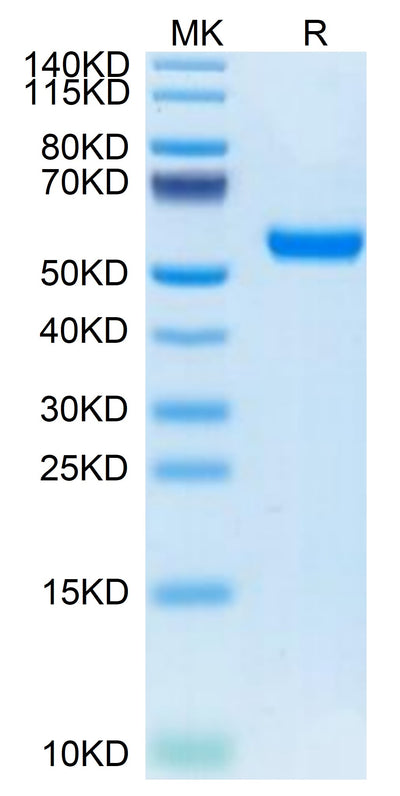 Mouse RNF43 on Tris-Bis PAGE under reduced condition. The purity is greater than 95%.Recombinant Mouse RNF43 Protein, Active