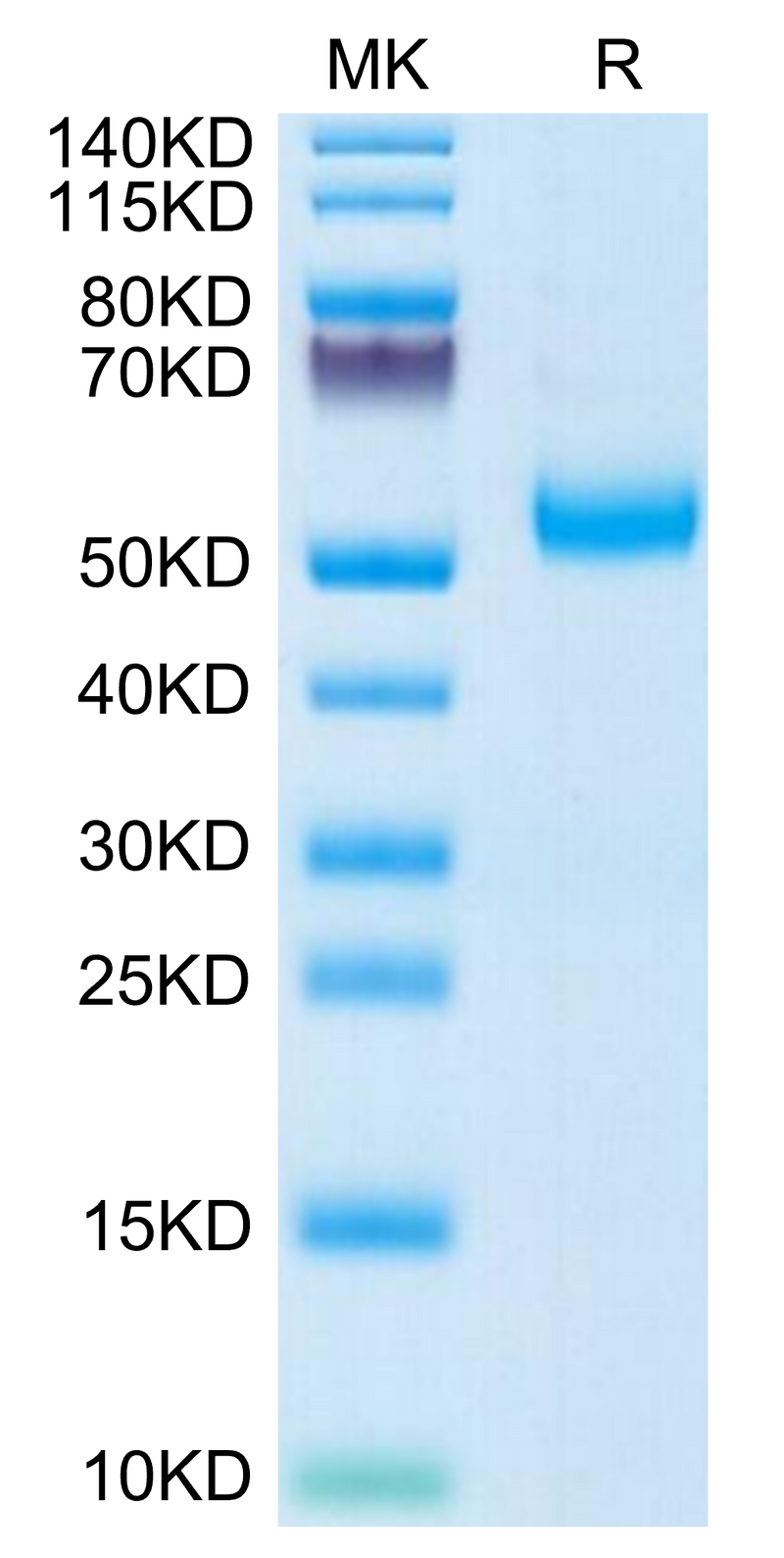 Human GFRA3 on Tris-Bis PAGE under reduced condition. The purity is greater than 95%.Recombinant Human GFRA3 Protein, Active