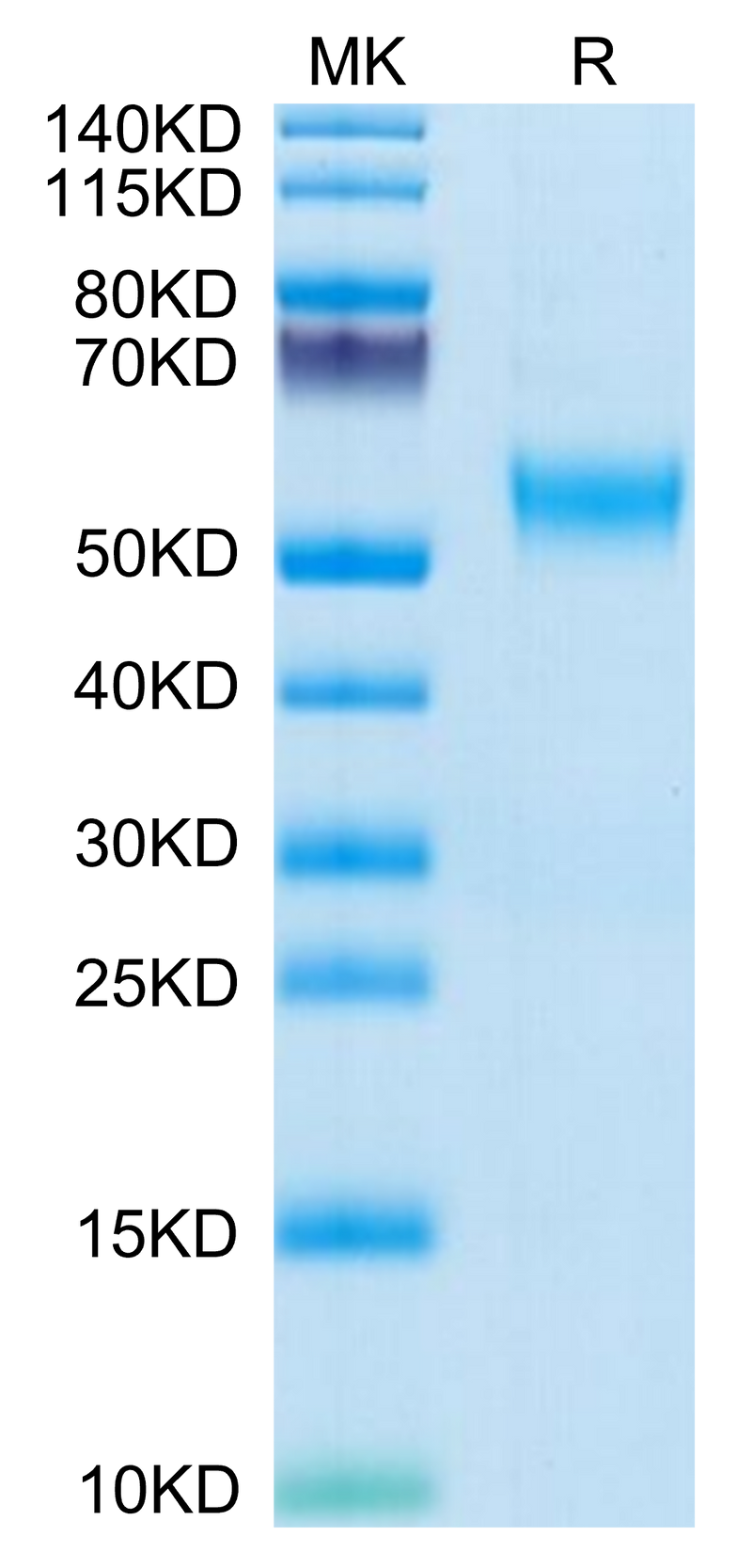 Human VSTM5 on Tris-Bis PAGE under reduced condition. The purity is greater than 95%.Recombinant Human VSTM5 Protein