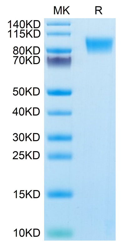 Human MUC18/CD146 on Tris-Bis PAGE under reduced condition. The purity is greater than 95%.Recombinant Human MUC18/CD146 Protein, Active