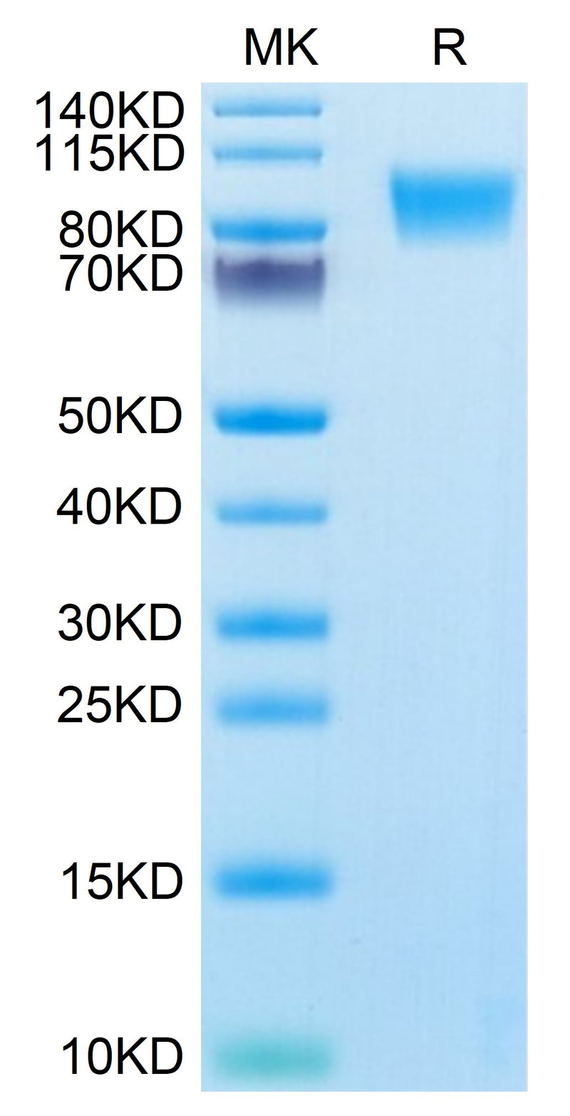 Human MUC18/CD146 on Tris-Bis PAGE under reduced condition. The purity is greater than 95%.Recombinant Human MUC18/CD146 Protein, Active