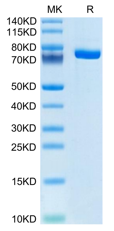 Human Coagulation factor XI on Tris-Bis PAGE under reduced condition. The purity is greater than 95%.Recombinant Human Coagulation factor XI Protein, Active