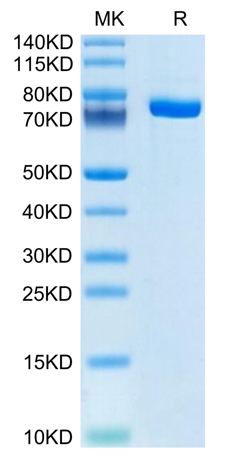 Human Coagulation factor XI on Tris-Bis PAGE under reduced condition. The purity is greater than 95%.Recombinant Human Coagulation factor XI Protein, Active