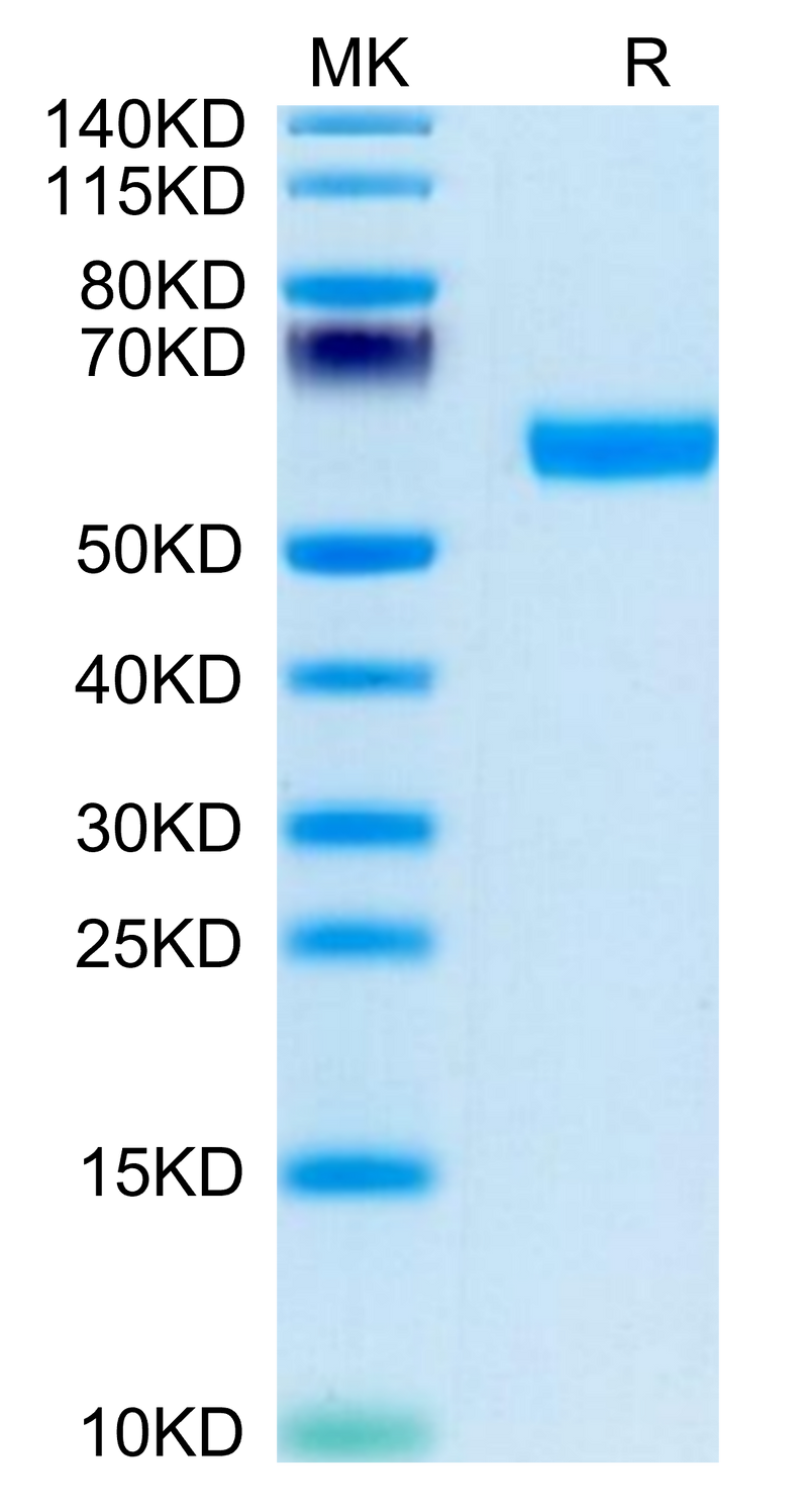 Human BDCA-2 on Tris-Bis PAGE under reduced condition. The purity is greater than 95%.Recombinant Human BDCA-2 Protein, Active