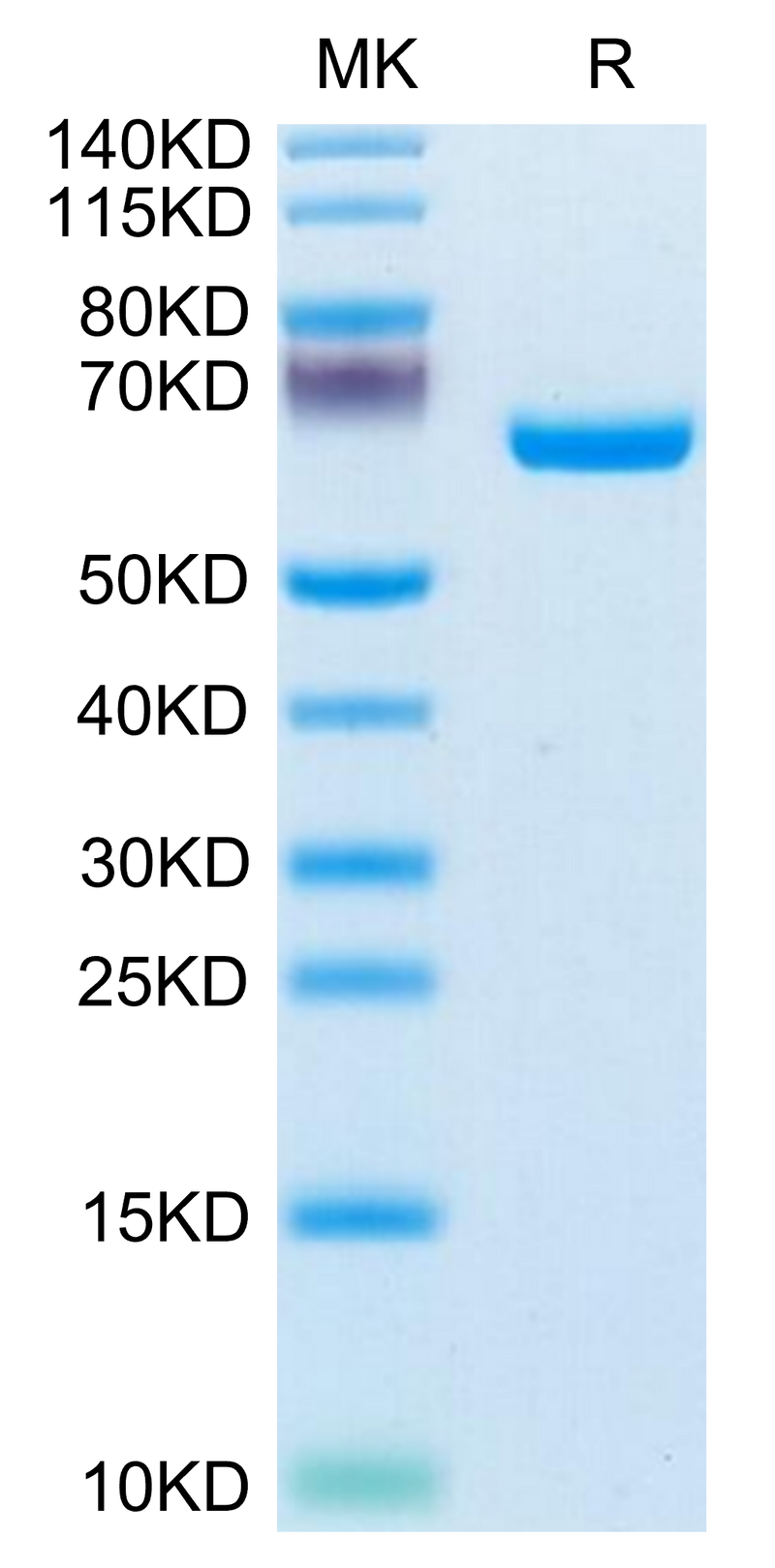 Human EphB3 on Tris-Bis PAGE under reduced condition. The purity is greater than 95%.Recombinant Human EphB3 Protein