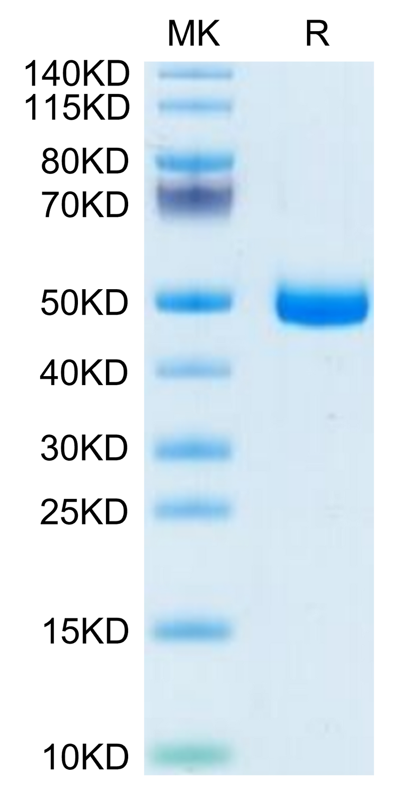 Mouse GFRA3 on Tris-Bis PAGE under reduced condition. The purity is greater than 95%.Recombinant Mouse GFRA3 Protein, Active