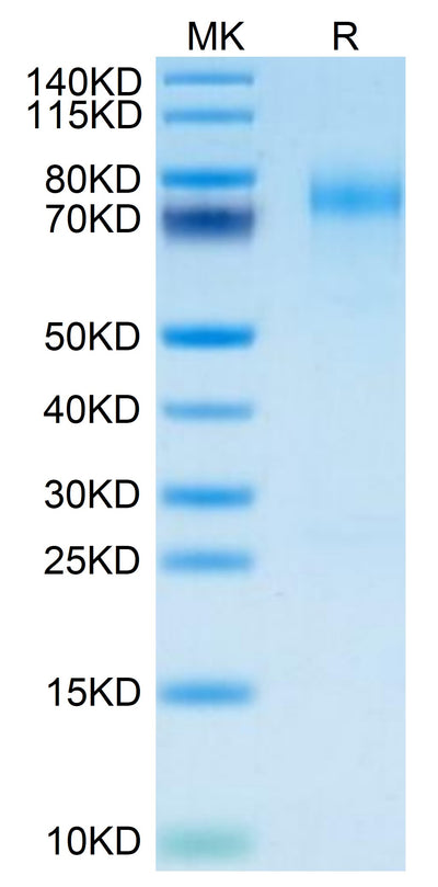 Mouse LYPD3 on Tris-Bis PAGE under reduced condition. The purity is greater than 95%.Recombinant Mouse LYPD3 Protein