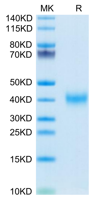 Mouse CLEC10A on Tris-Bis PAGE under reduced condition. The purity is greater than 95%.Recombinant Mouse CLEC10A Protein