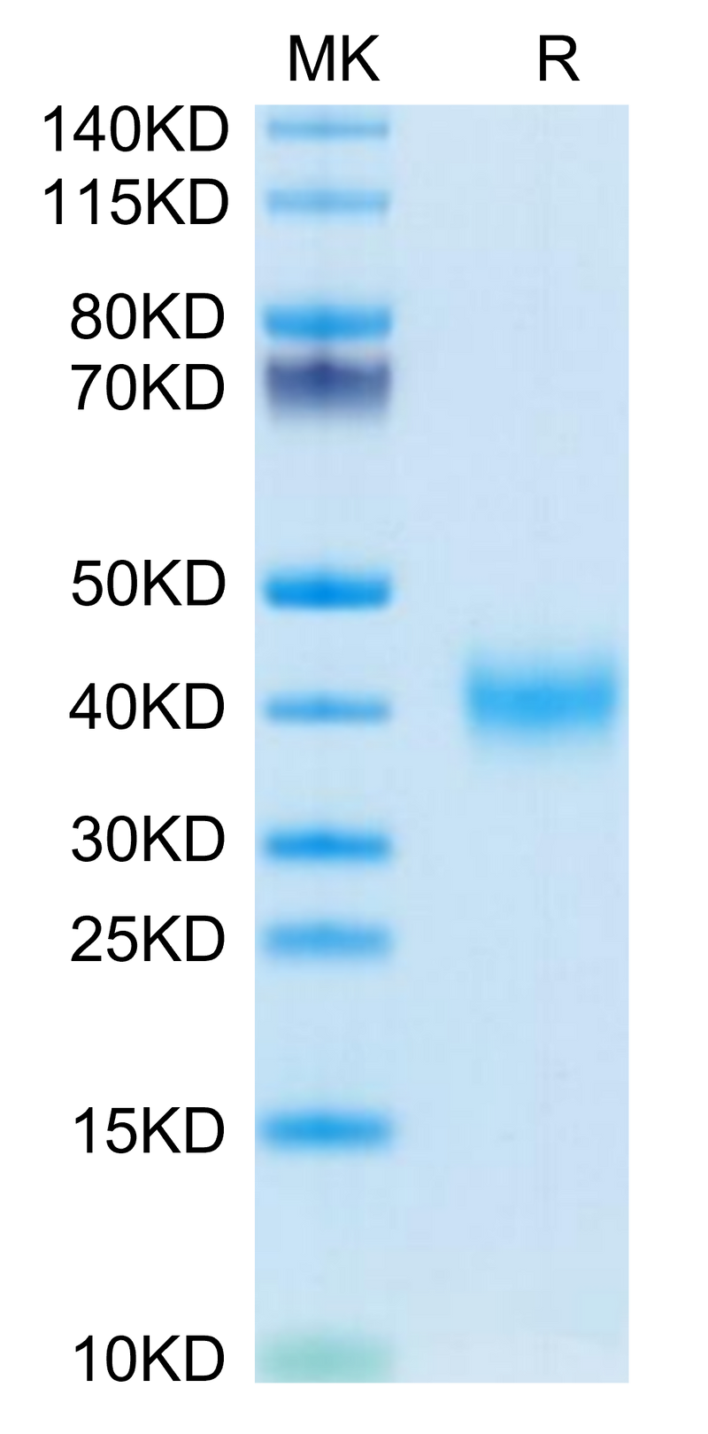 Mouse CLEC10A on Tris-Bis PAGE under reduced condition. The purity is greater than 95%.Recombinant Mouse CLEC10A Protein