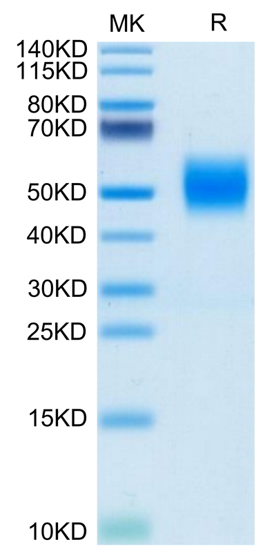 Biotinylated Human FGFR2 beta (IIIc) on Tris-Bis PAGE under reduced condition. The purity is greater than 95%.Biotinylated Human FGFR2 beta (IIIc) Protein, Active