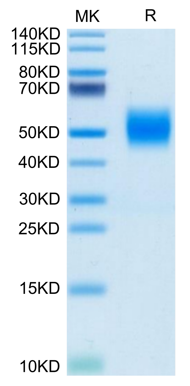 Biotinylated Human FGFR2 beta (IIIc) on Tris-Bis PAGE under reduced condition. The purity is greater than 95%.Biotinylated Human FGFR2 beta (IIIc) Protein, Active