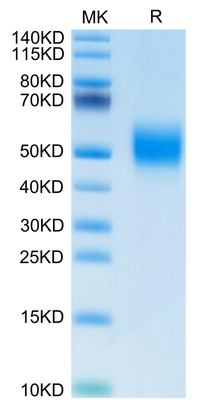 Biotinylated Human FGFR2 beta (IIIb) on Tris-Bis PAGE under reduced condition. The purity is greater than 95%.Biotinylated Human FGFR2 beta (IIIb) Protein, Active