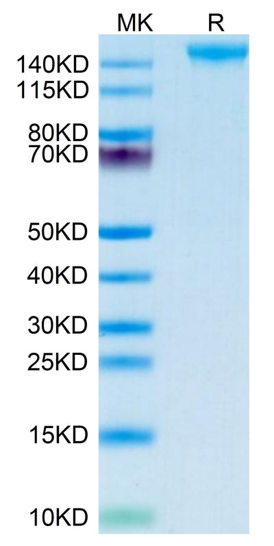 Mouse SEZ6 on Tris-Bis PAGE under reduced condition. The purity is greater than 95%.Recombinant Mouse SEZ6 Protein, Active