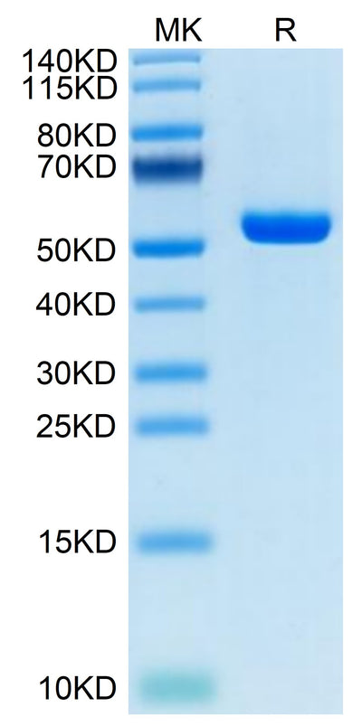 Human HLA-A*02:01&B2M&P53 R175H (HMTEVVRHC) Monomer on Tris-Bis PAGE under reduced condition. The purity is greater than 95%.Recombinant Human HLA-A*02:01&B2M&P53 R175H (HMTEVVRHC) Monomer Protein, Active