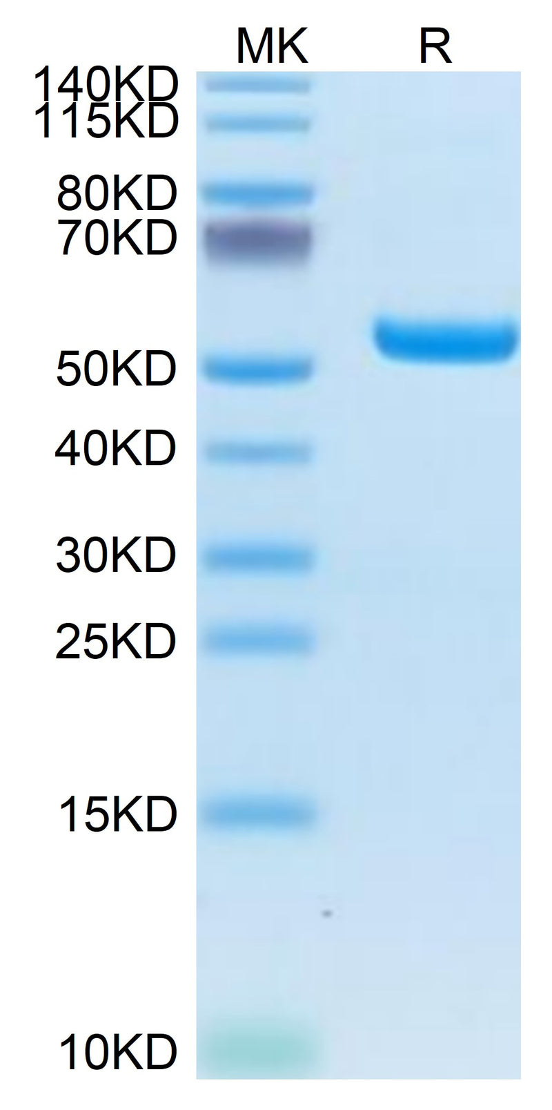 Biotinylated Human HLA-A*02:01&B2M&LMP2 (CLGGLLTMV) Monomer on Tris-Bis PAGE under reduced condition. The purity is greater than 95%.Biotinylated Human HLA-A*02:01&B2M&LMP2 (CLGGLLTMV) Monomer Protein, Active