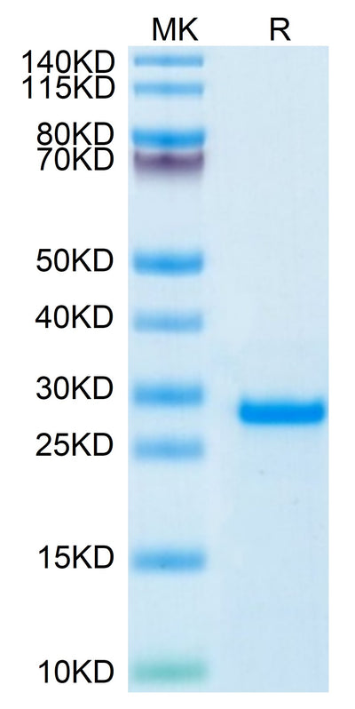 Human PS20 on Tris-Bis PAGE under reduced condition. The purity is greater than 95%.Recombinant Human PS20 Protein
