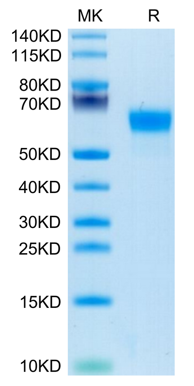 Human Factor H on Tris-Bis PAGE under reduced condition. The purity is greater than 95%.Recombinant Human Factor H/CFH Protein, Active