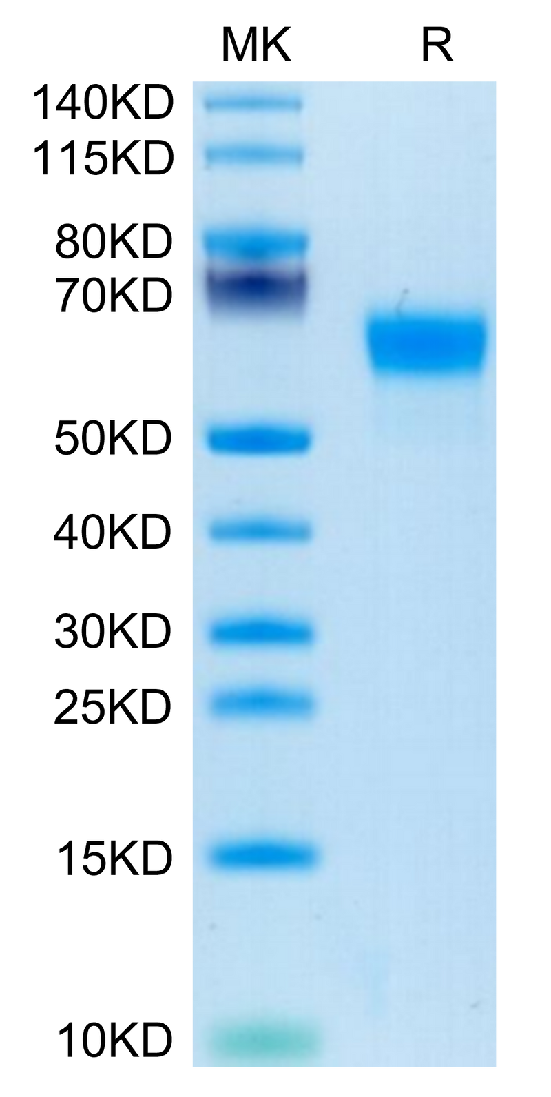 Human Factor H on Tris-Bis PAGE under reduced condition. The purity is greater than 95%.Recombinant Human Factor H/CFH Protein, Active