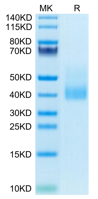 Human CLEC10A on Tris-Bis PAGE under reduced condition. The purity is greater than 95%.Recombinant Human CLEC10A Protein