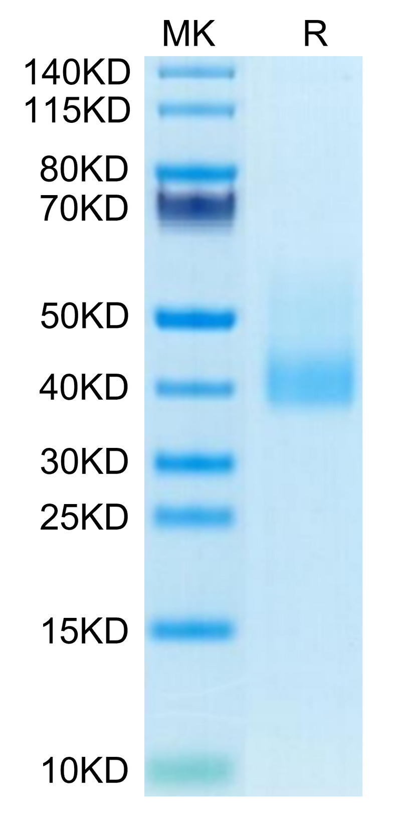 Human CLEC10A on Tris-Bis PAGE under reduced condition. The purity is greater than 95%.Recombinant Human CLEC10A Protein