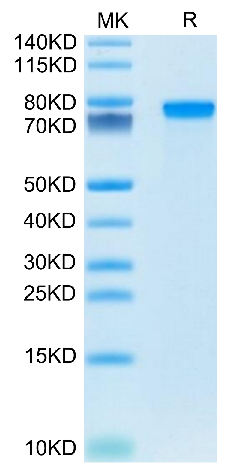 Mouse GEP on Tris-Bis PAGE under reduced condition. The purity is greater than 95%.Recombinant Mouse GEP Protein