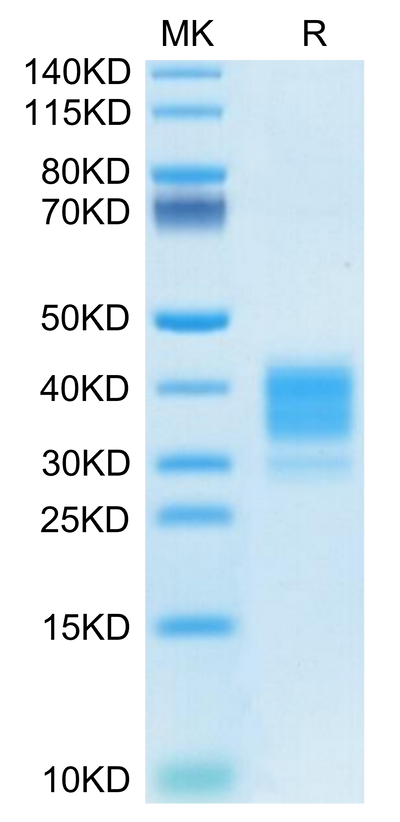 Mouse Fc gamma RIV on Tris-Bis PAGE under reduced condition. The purity is greater than 95%.Recombinant Mouse Fc gamma RIV/CD16-2 Protein, Active