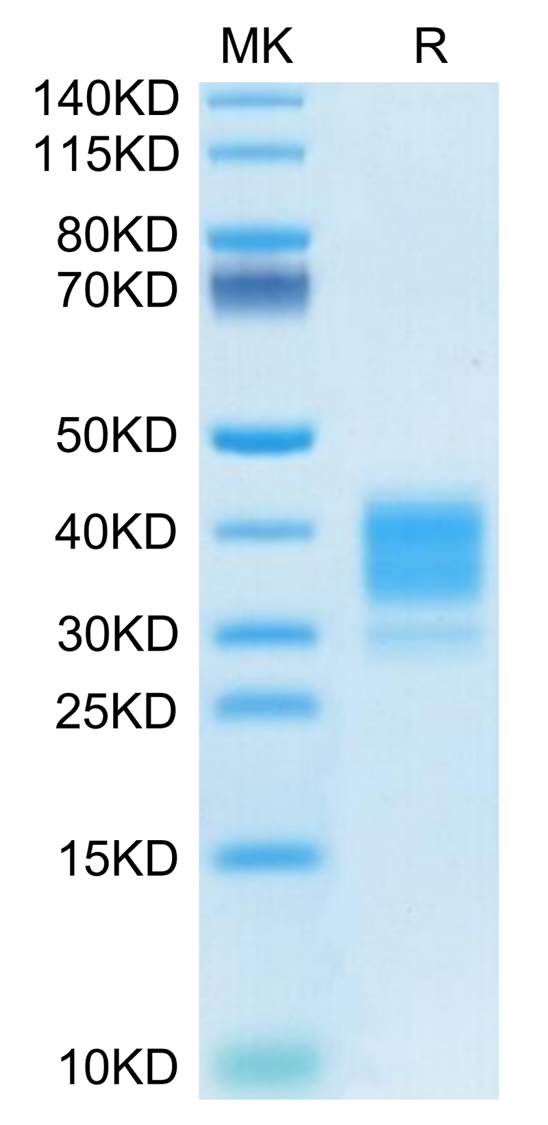 Mouse Fc gamma RIV on Tris-Bis PAGE under reduced condition. The purity is greater than 95%.