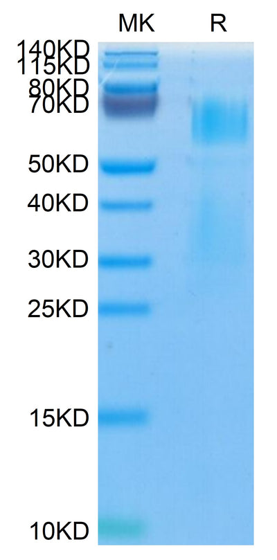 Mouse MMP-8 on Tris-Bis PAGE under reduced condition. The purity is greater than 95%.Recombinant Mouse MMP-8 Protein (pro form)