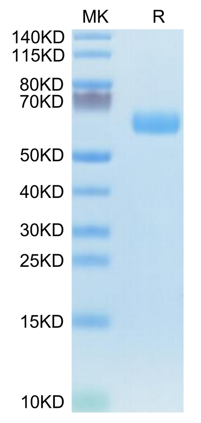Mouse WISP1 on Tris-Bis PAGE under reduced condition. The purity is greater than 95%.Recombinant Mouse WISP1 Protein